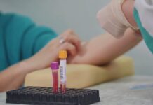 Centro TAO di Lavagna, le rassicurazione di ASL 4. Il parere del medico generico